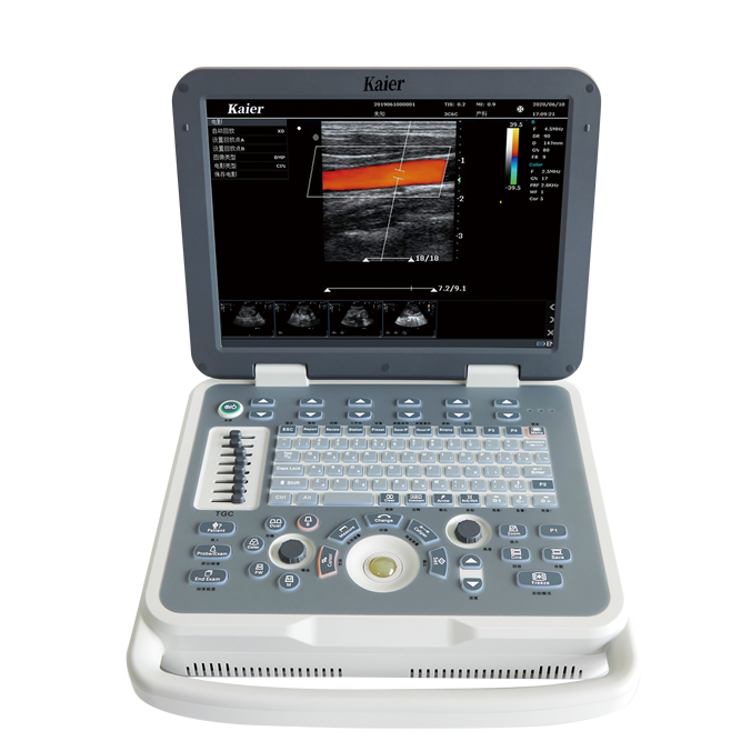 High Quality Medical Diagnosis Equipment Black and White Ultrasound Scanner Device for Sale