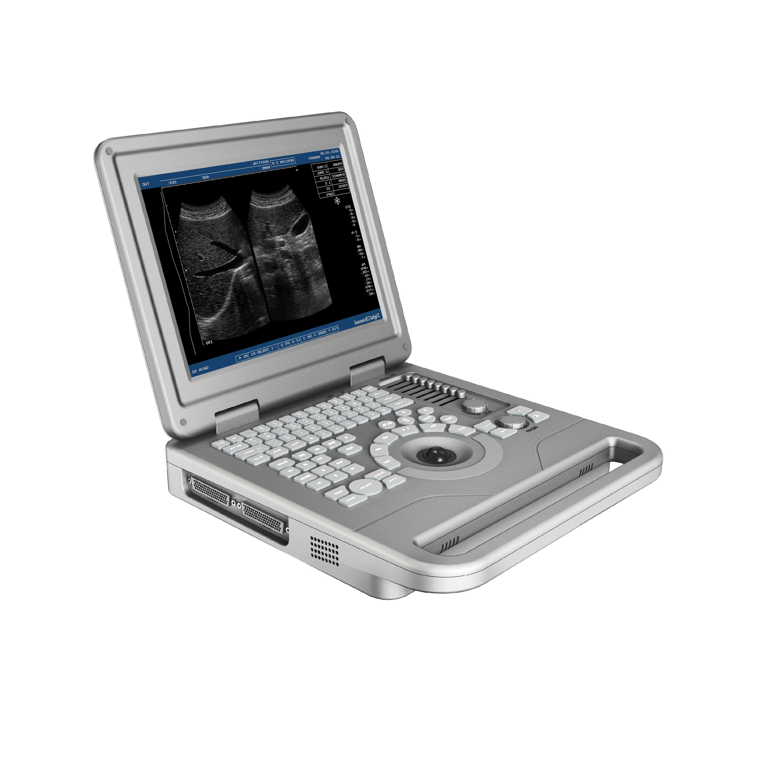 Best Quality Black And White Portable Ultrasound Machine Ultrasonic Diagnostic System For Human Being MSLPU11