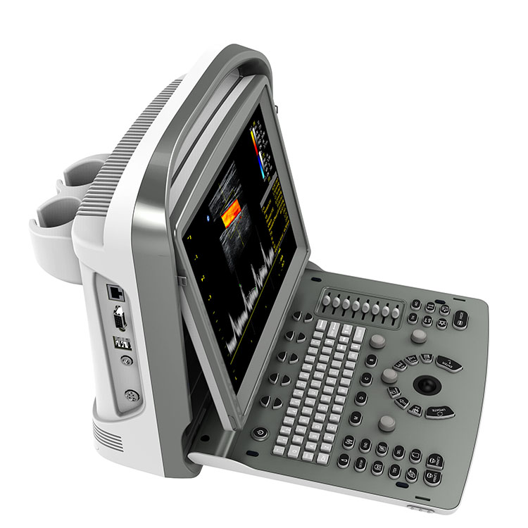 Chison Ultrasound ECO6 Color Doppler 4D Laptop Style Hat Sale Hospital Medical Ultrasound