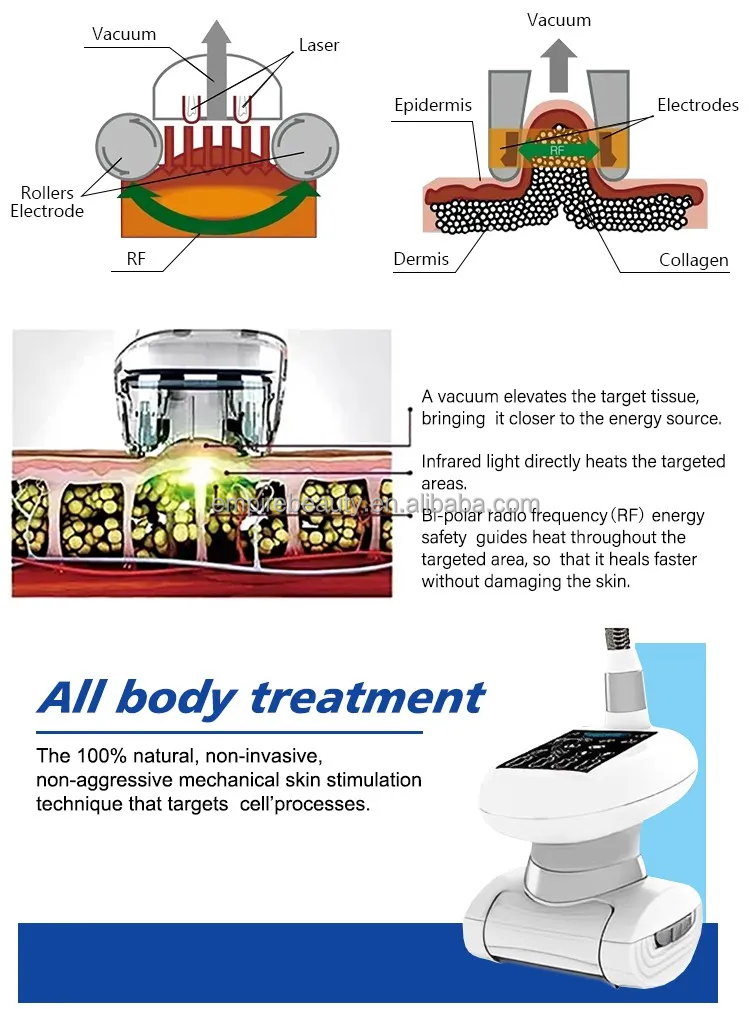 New product face massager Body Sculpting Anti Cellulite Massage Roller Machine Vera Slimming