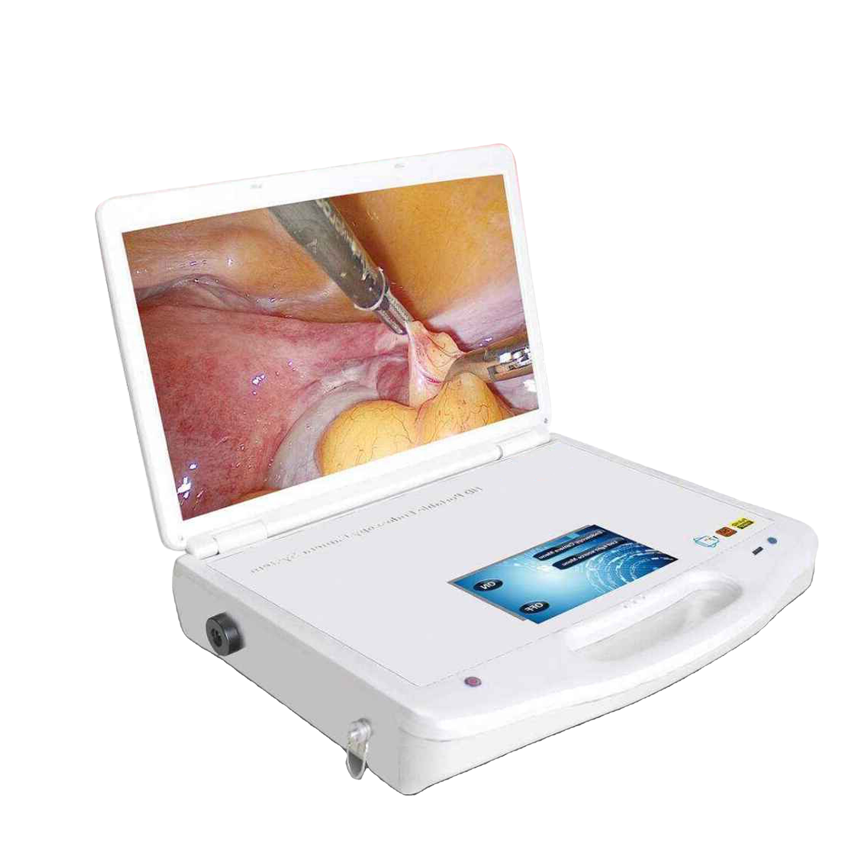 IN-P031 Medical Digital Surgical Fiberscope Portable ENT USB Endoscope Camera