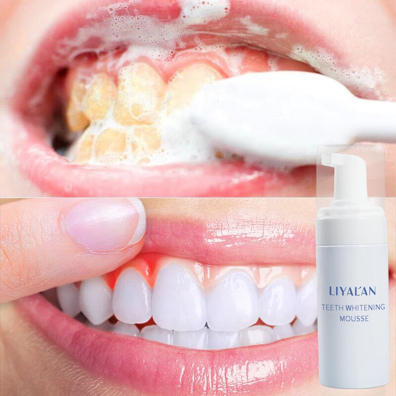 Wholesale Professional Oral Hygiene Teeth Whitening Tartar Remover Plaque Stains Cleaner Mousse