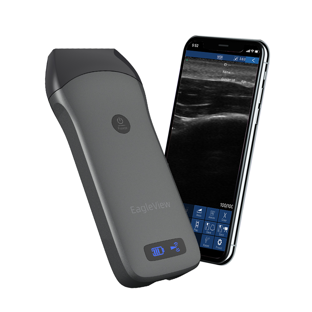 Weleaglue leview высокоинтенсивный сфокусированный медицинский аппарат беспроводной портативный ультразвуковой сканер