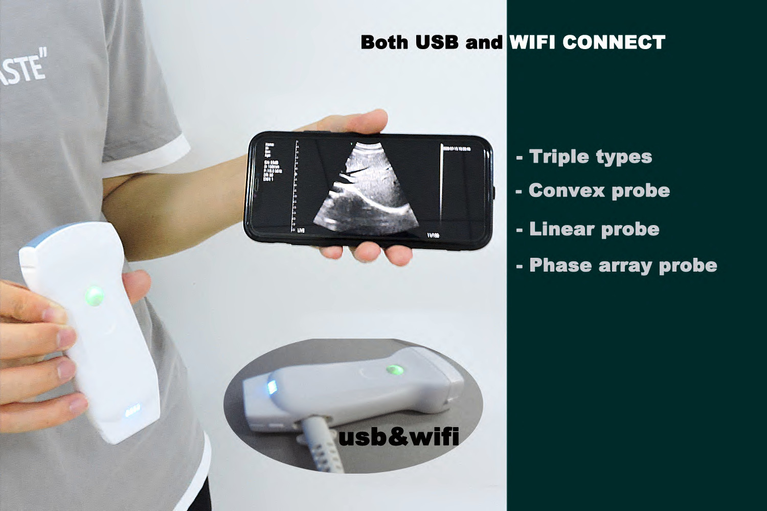 Высокое качество 128 элементы 3 в 1 цветной допплер Wi-Fi и USB Ультразвуковой выпуклый линейный сердечно-сосудистых двойной зонд C10RL