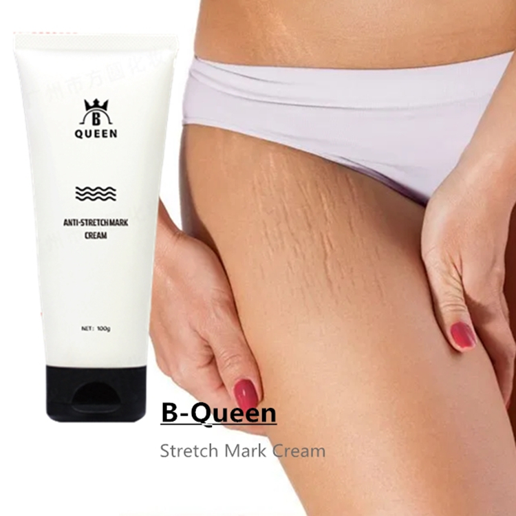 2021 Top Sale Effective Stretch Mark Repairing Cream