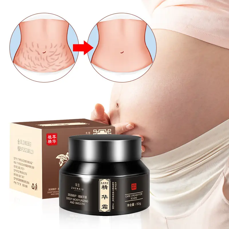 High Quality And Effective Removal Fade Scars Lifting And Firming 50g Stretch Mark Cream
