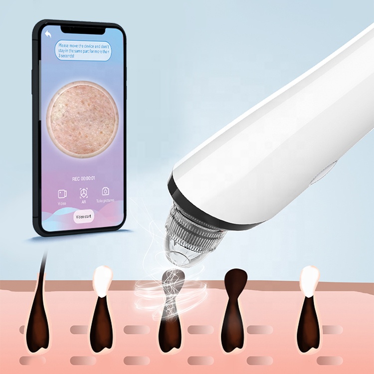 Intelligent Visual Deep Skin Care Pore Cleaner Nose Blackhead Remover Kit Suction Vacuum With Camera Mini Blackhead Removal