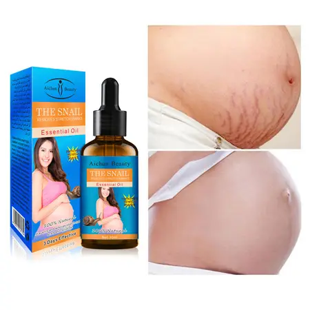 Skin Care Treatment Cream For Pregnant Stretch Marks Remover Massage Oil