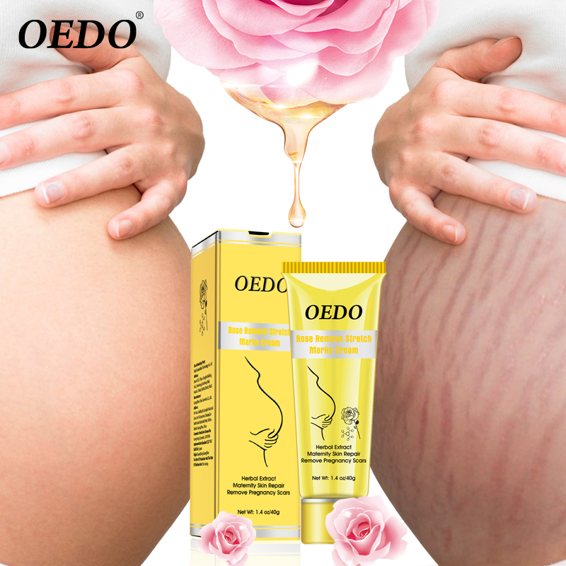Rose removes stretch mark cream anti-wrinkle anti-aging pregnant woman skin care repair pregnancy scar treatment body skin care