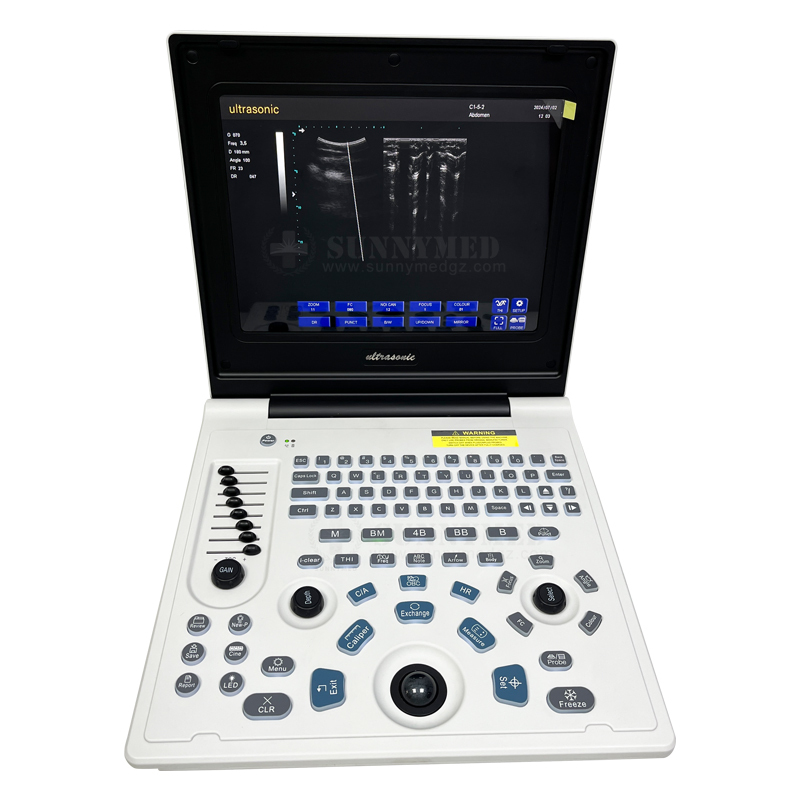 SY-AX50-1 Laptop Full-digital Ultrasound Diagnostic System Easy to Carry