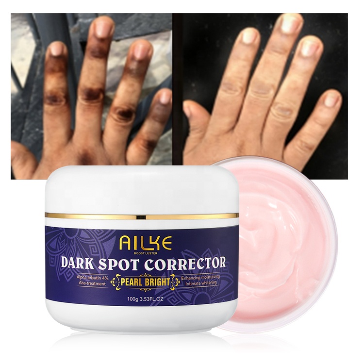 AILKE Strong Removal 7 Days Dark Spot Corrector Skin Care Private Label Whitening Freckle Face Cream