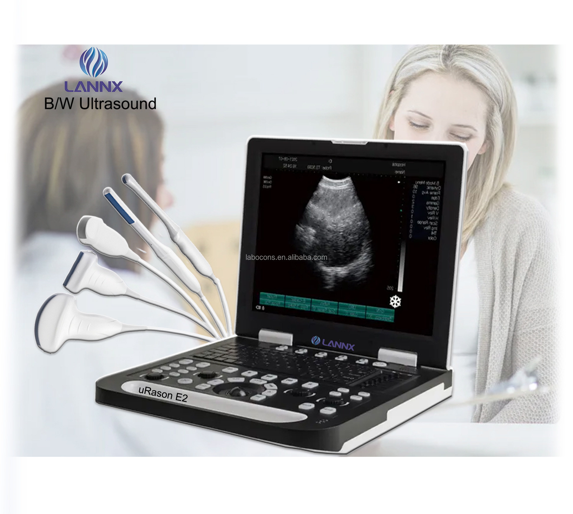 LANNX uRason E2 Excellent medical 3D USG Full Digital Ultrasonic Diagnostic Imaging System B/W Portable Ultrasound Machine
