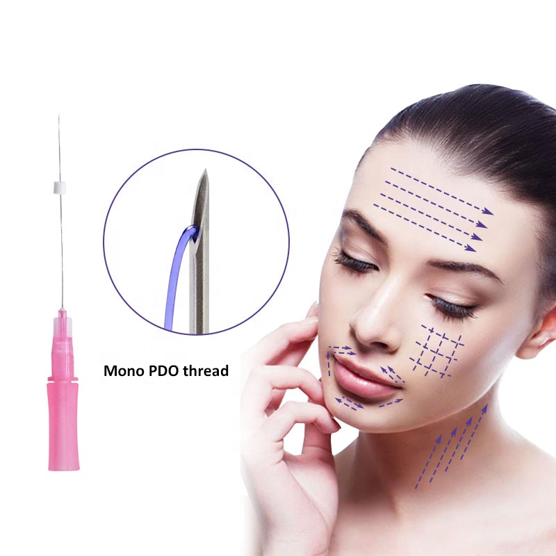 Absorbable suture korea fios mint pdo barb mini thread
