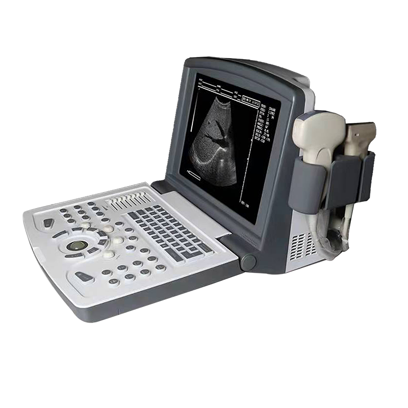 High Definition Ultrasonic Equipment Multi-probe Portable Laptop Ultrasound Scanner Machine