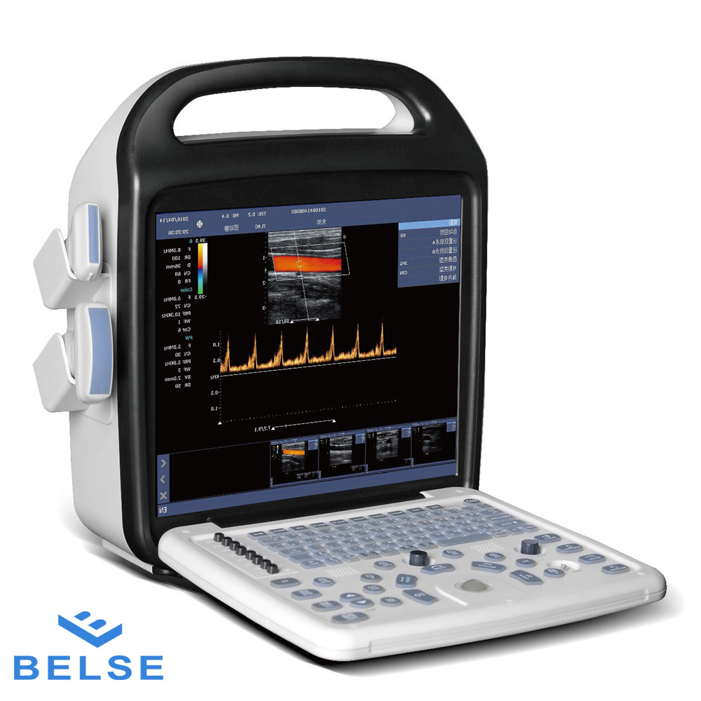Portable ultrasound machine   color doppler android ultrasound probe