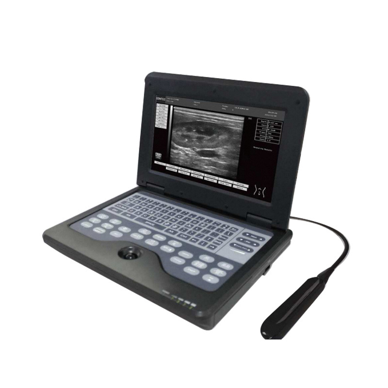 Professional Veterinary Monitoring Devices Medical Ultrasound Instruments for Ultrasonography
