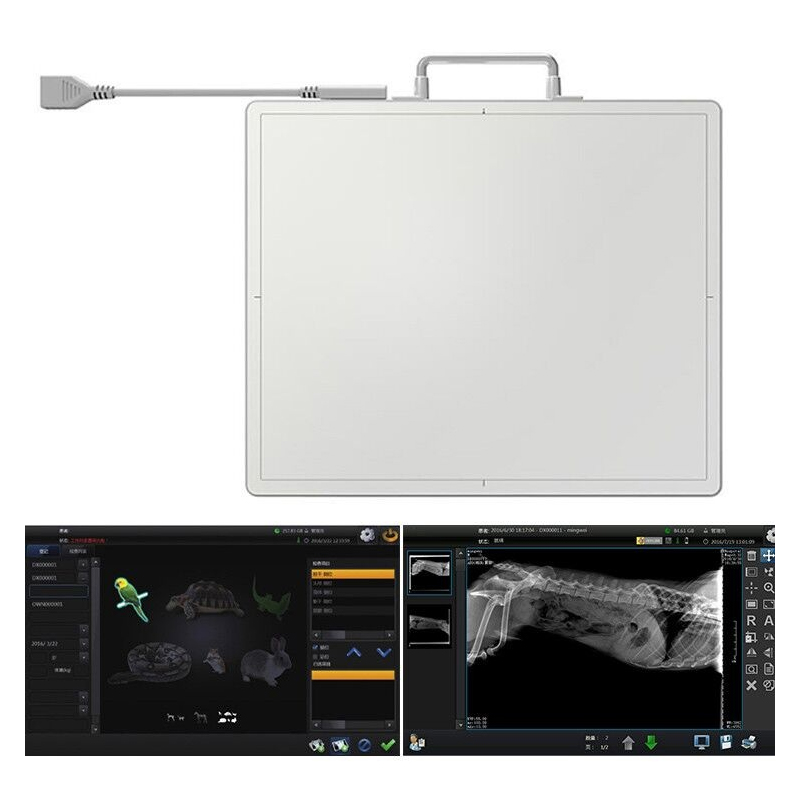 Competitive Price YSFPD4343A X Ray Machine FPD Digital Wire OR Wireless Flat Panel Detector