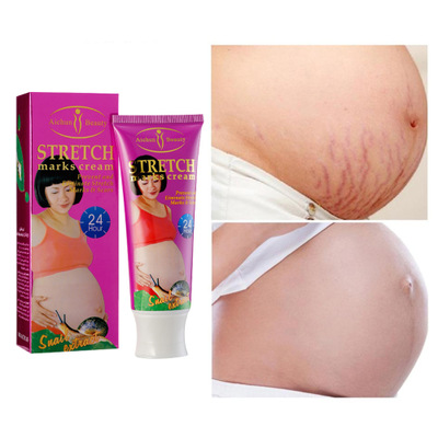 OEM/ODM Stretch Marks Removal Cream Skin Pregnancy Cream