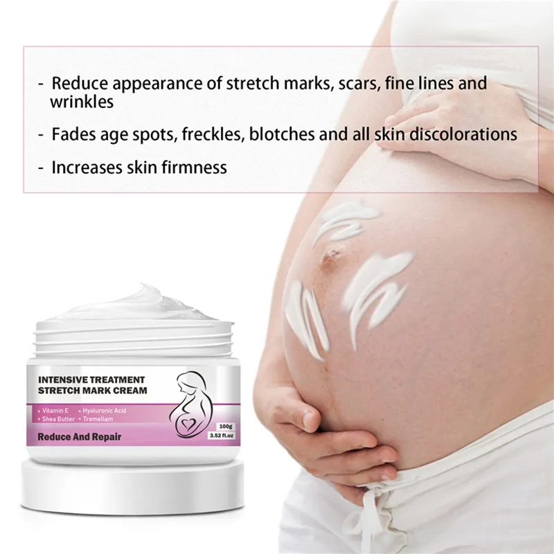 Private Label 100% Natural Vegan Anti Postpartum Deep Scar Removal Stretch Mark Cream