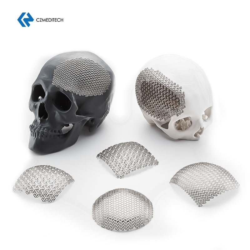 CE & ISO Maxillofacial Mini Plate Stainless Steel Surgical Implants Maxillofacial Plates And Instruments Neurosurgery
