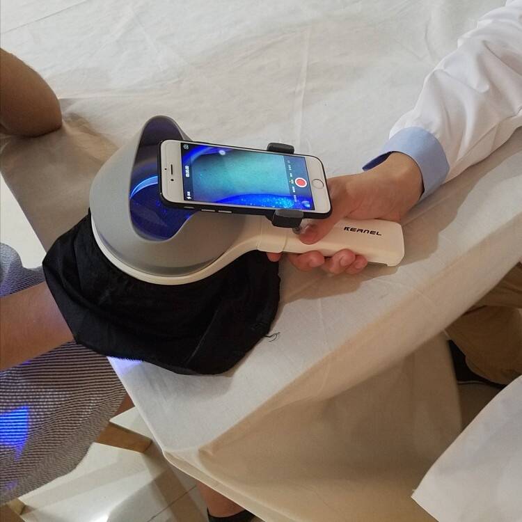 KN- 9000B Medical CE PMA 510K approved Combined Light UVA and LED wood lamp examination skin analyzer for skin disease test