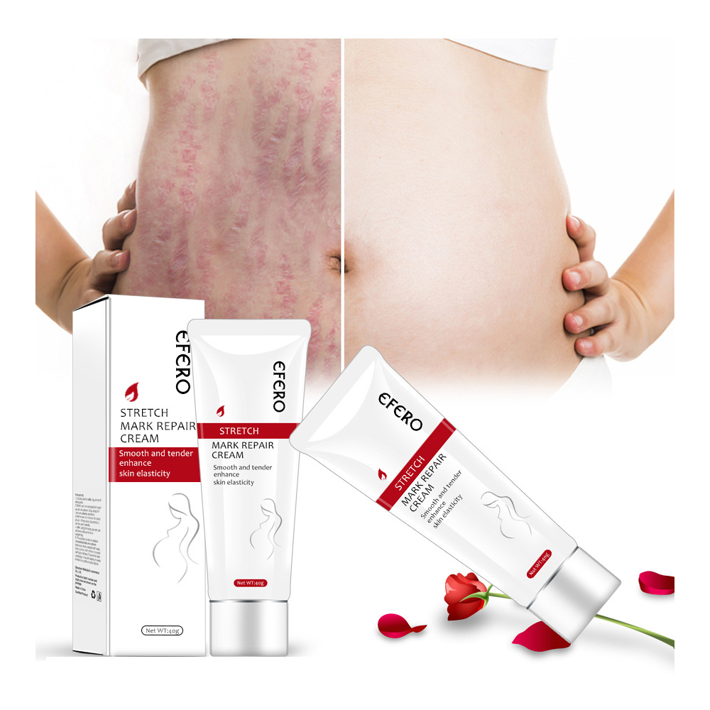 Wholesale maternity skin care scar stretch marks removal cream remove pregnancy stretch mark cream