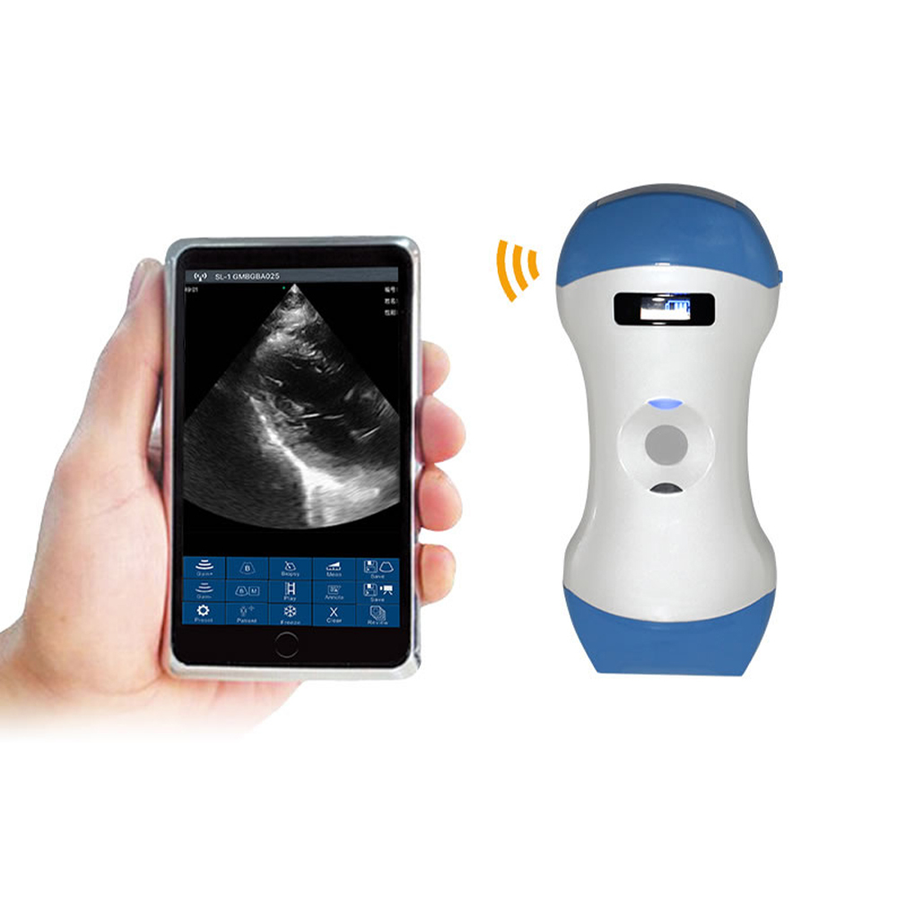 Suresult Diagnostic Devices Scanner and Ultrasound Probe Used for Emergency Surgery