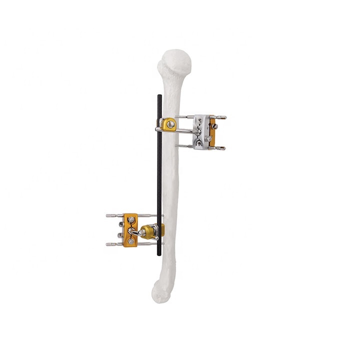 Factory Price Orthopedic External Fixation Humeral Shaft External Fixators