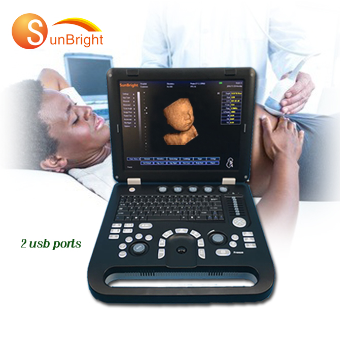 Высокое качество Портативный сердечный OB GYN 3D 4D эхокардиография ультразвуковая машина SUN-800D
