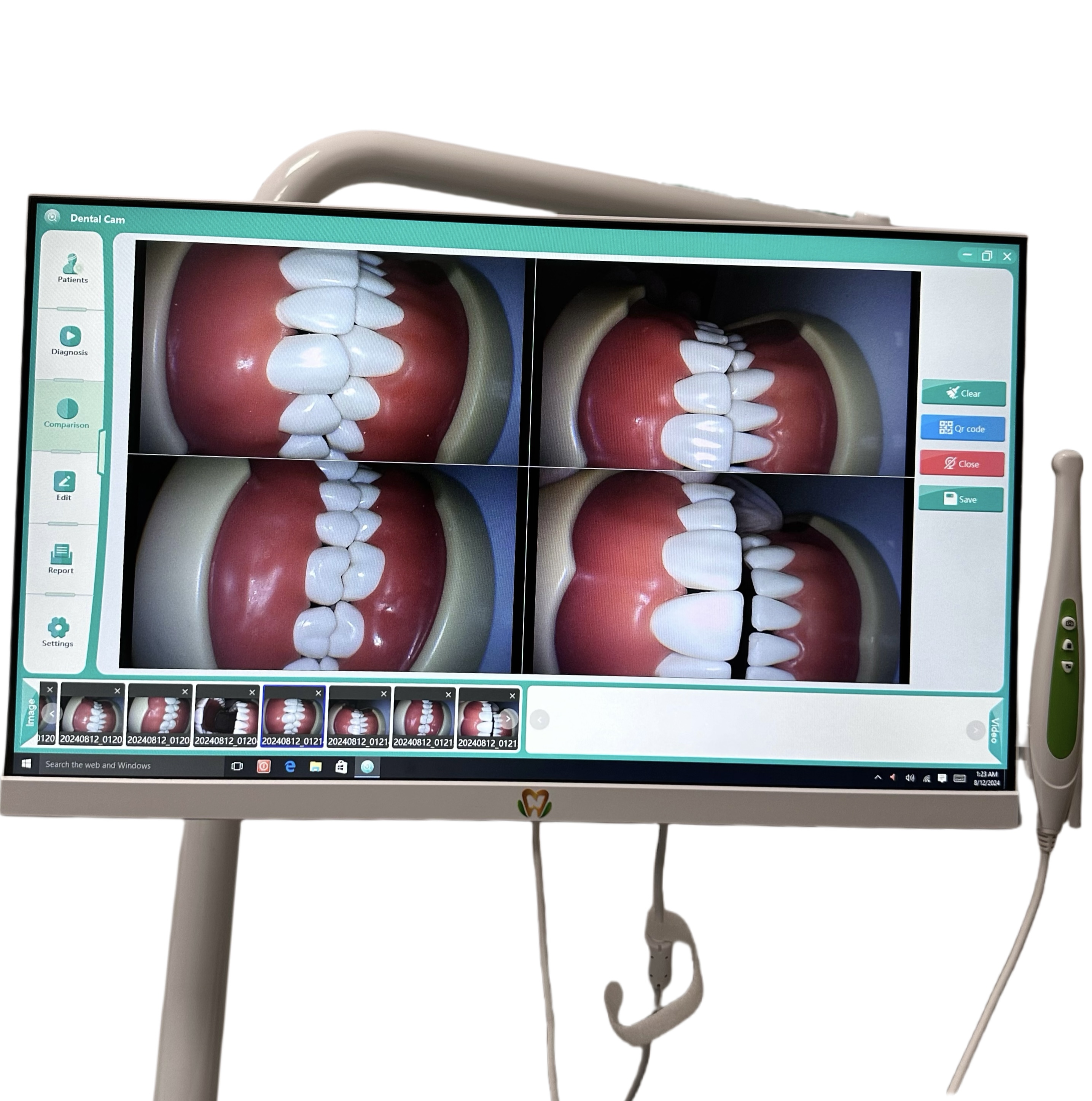 24 inch HD Digital oral camera WIFI dental intraoral camera All In One Computer intraoral camera with bracket holder