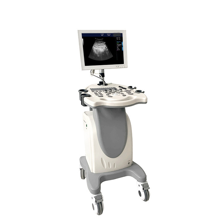 UBW370P Made-in-China Trollely Ultrasonic Scanner Ultrasound Machine with Low Price for Sale