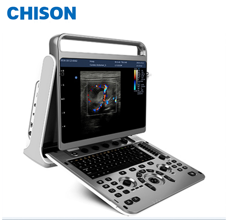 Ультразвуковой допплер CHISON EBit30, цветной сердечный профессиональный цветной допплер 3D 4D, портативный медицинский ультразвуковой сканер