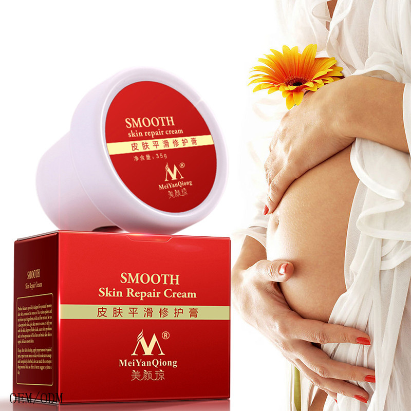 High Quality Powerful Stretch Marks Remover Skin Repair Cream Treatment Scar Removal Pregnancy Cream