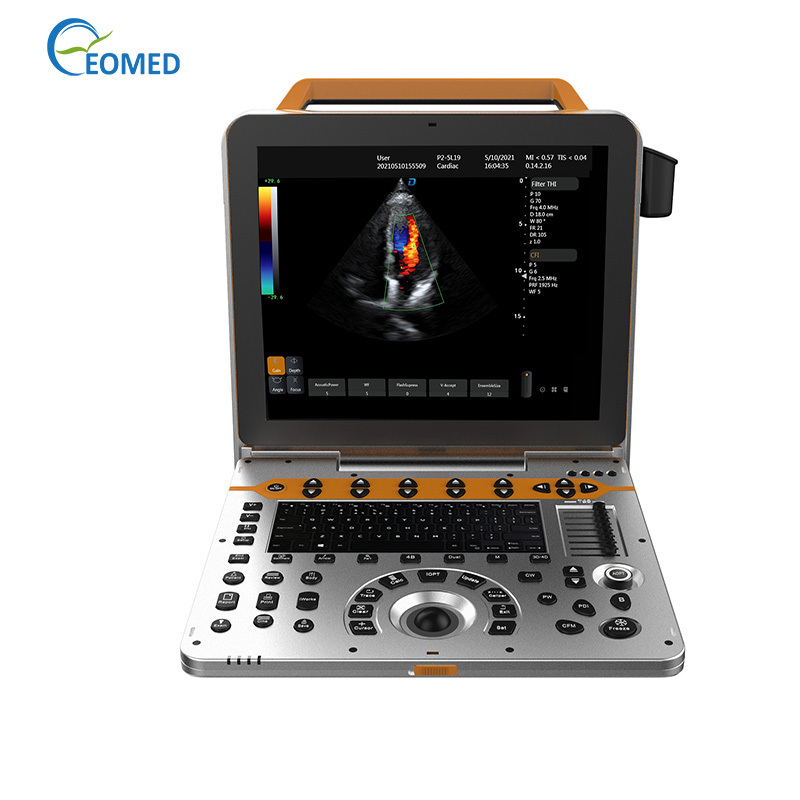 EO-P60 Portable Color Ultrasonic Diagnostic Apparatus ultrasonic hospital diagnostic With Trapezoidal Imaging Function