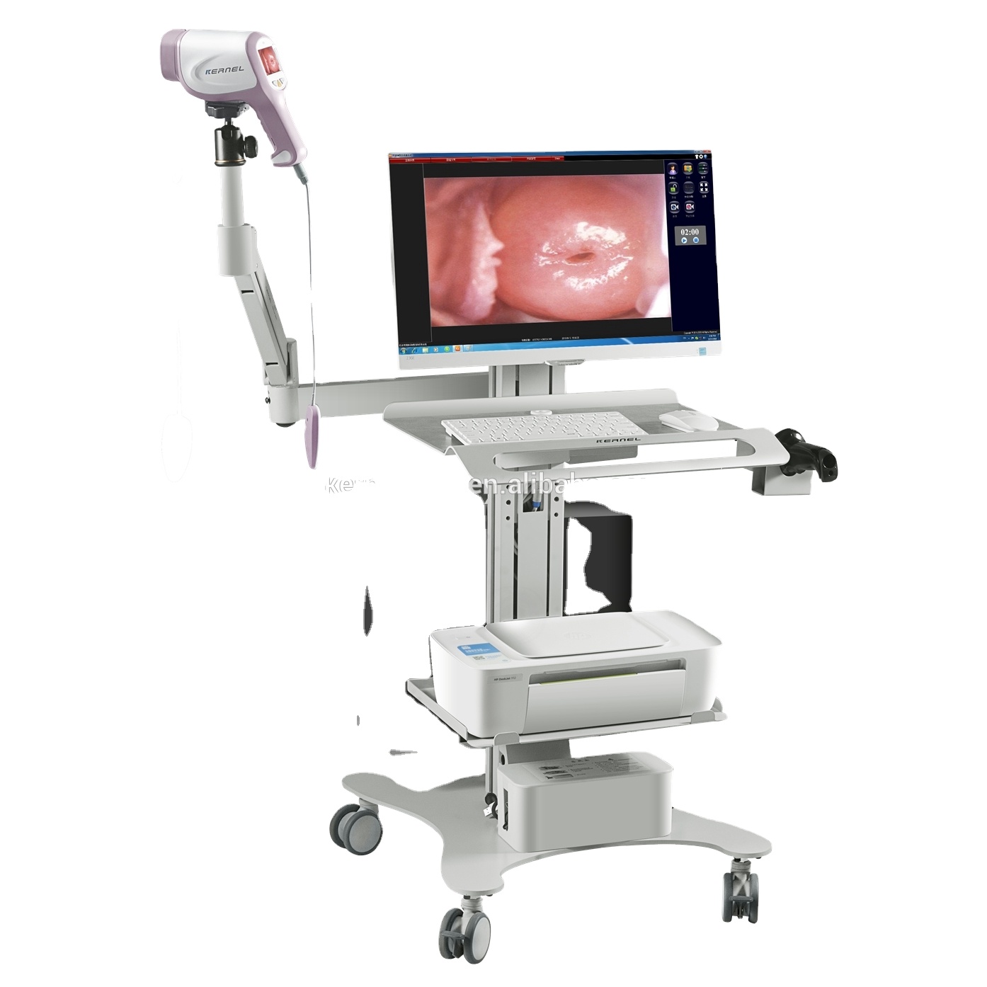 Kernel KN-2200IH China colposcopio digital goldway wireless video mini camara gynecology precio portatil usb medical colposcope