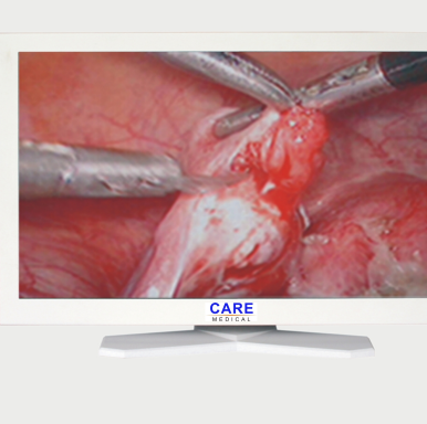 MT Medical Hot Sales Hospital 24 inch Medical Monitor With Laparoscopy Tower