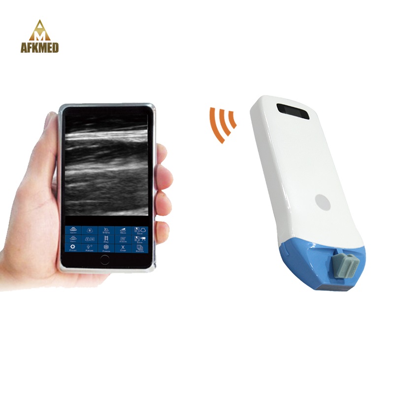 14-10 MHz LINEAR 256 Elements Wireless Ultrasound Probe Scanner