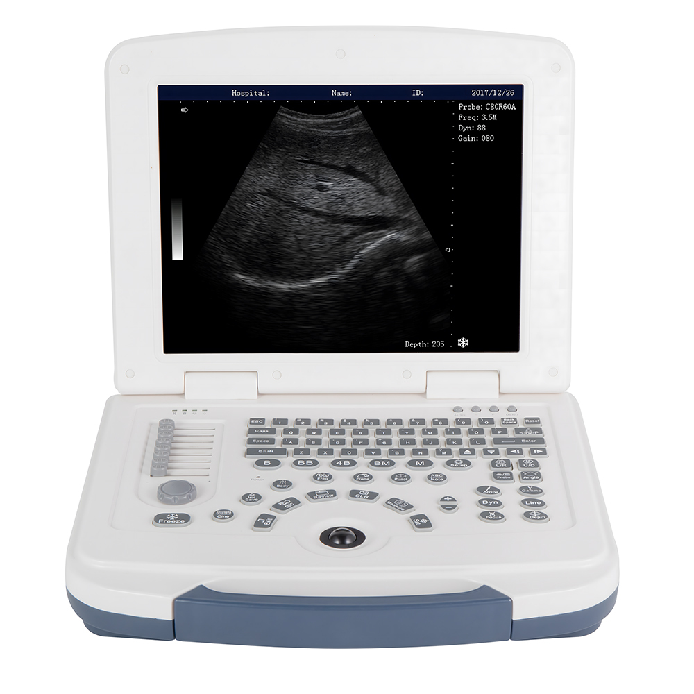 Professional Portable Laptop Full-Digital Ultrasound Diagnostic Scanner Metal and Plastic Material Mechanic Power Source