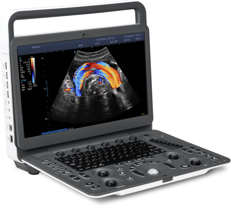 Sonoscape E2V_vet medical ultrasound instruments ecografo sonoscape portable color doppler ultrasound machine with 2 probes