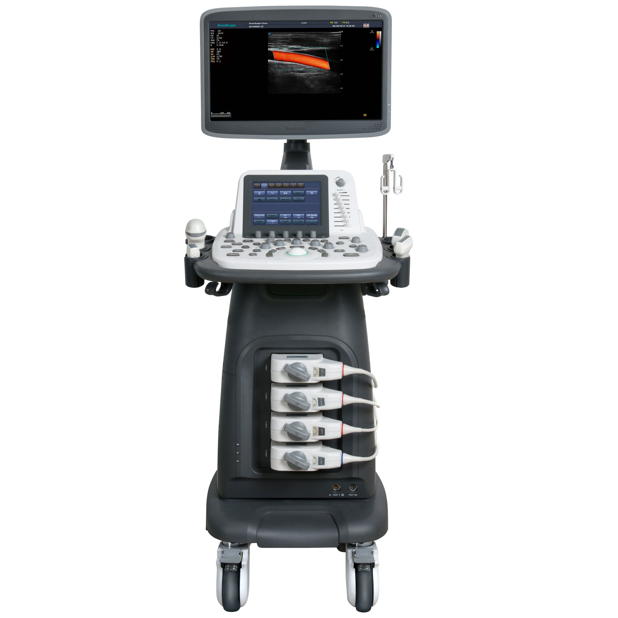 Sonoscape S22 Trolley 4D цветная допплеровская ультразвуковая система, 8 дюймов, сенсорный экран 18,5 дюйма, ЖК-дисплей