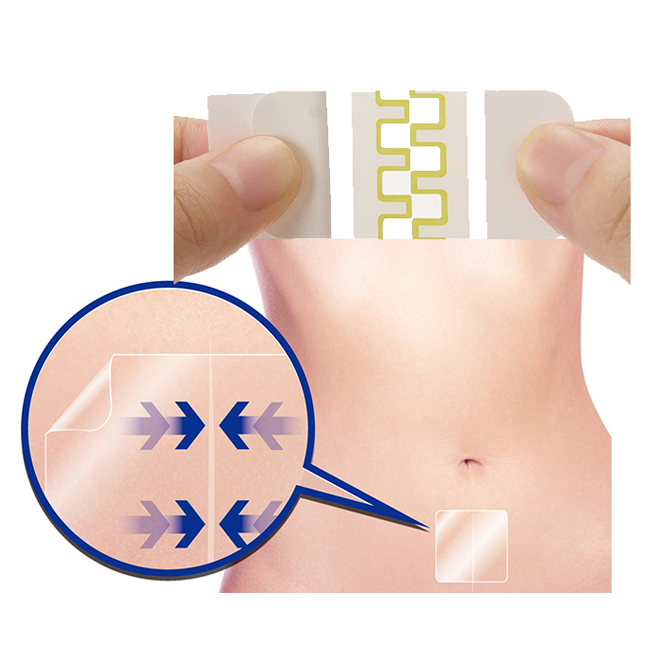 Japan Skinix Medic Adhesive Wound Dressing PU Tape For Scar Caesarean Section