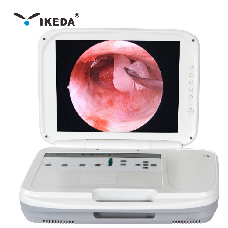 Urology hysteroscope medical endoscopy camera hospital equipment