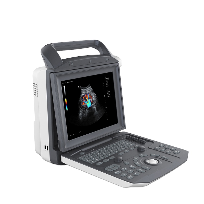 Hospital Imaging Equipment Ergonomic Design Medical ultrasound instruments Doppler ultrasound machine portable