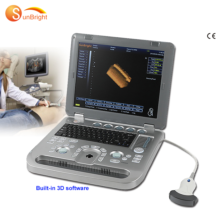 SUN-800D беспроводное портативное Акушерское ультразвуковое оборудование 3d