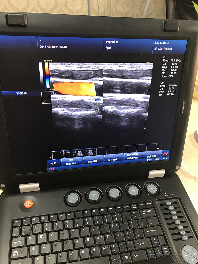 Compete mindray cost effective color Doppler z5 z6 price mindray DP series ecografo