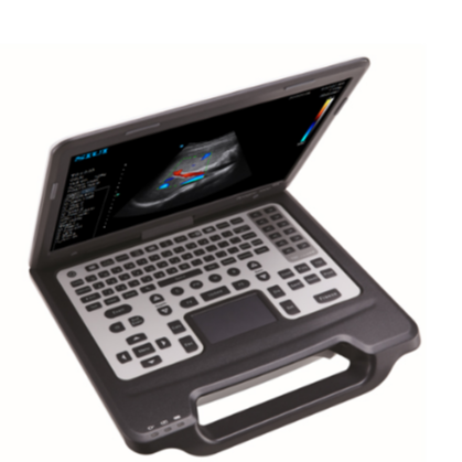 Ultrasound Machine be easy to carry about Color Doppler ultrasound intelligence Ultrasound Machine