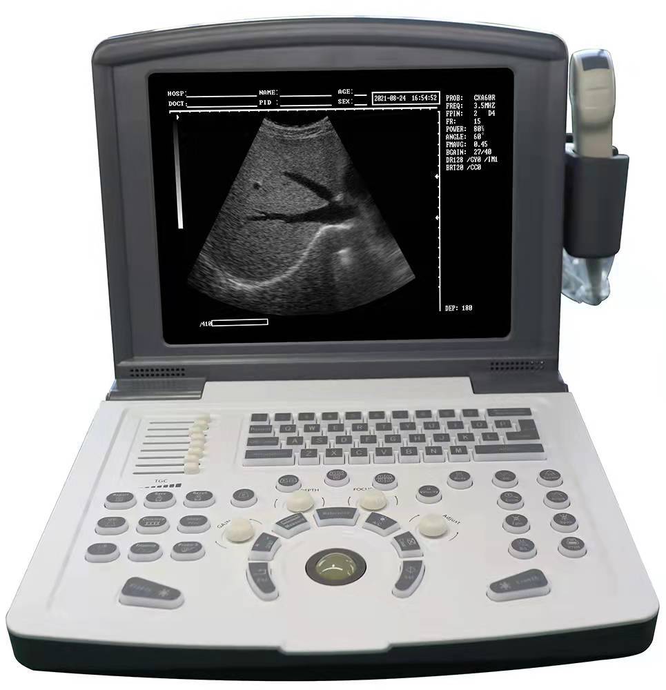 Medical Ultra sound Diagnostic Equipment Full Digital Ultrasonic Diagnostic Imaging System Portable B/W Ultrasound Machine