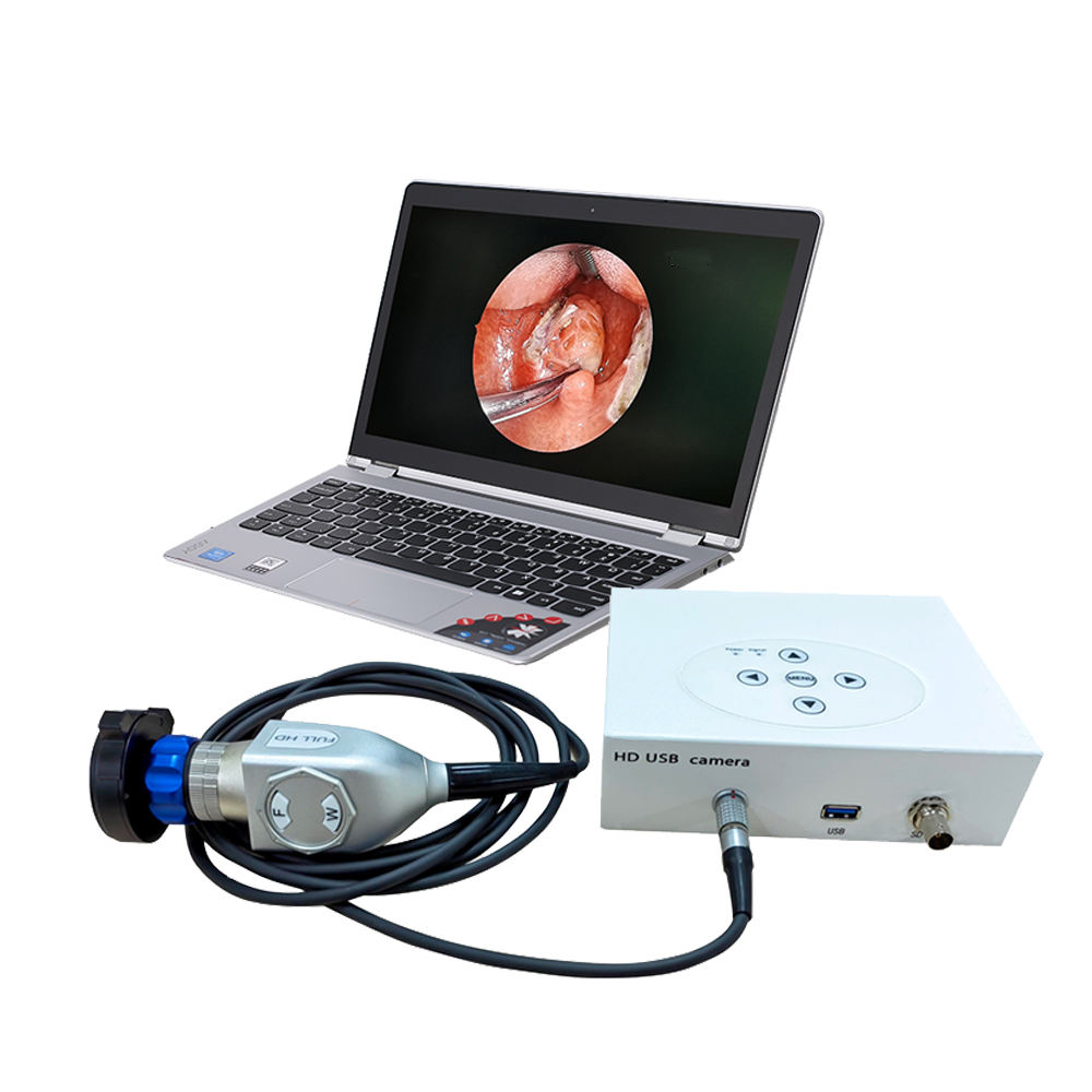 IN-HD7020 15.6 Inch 3 In 1 Usb Hdmi Hd 1080p Arthroscopy Imaging System Portable Light Source Endoscope Camera System
