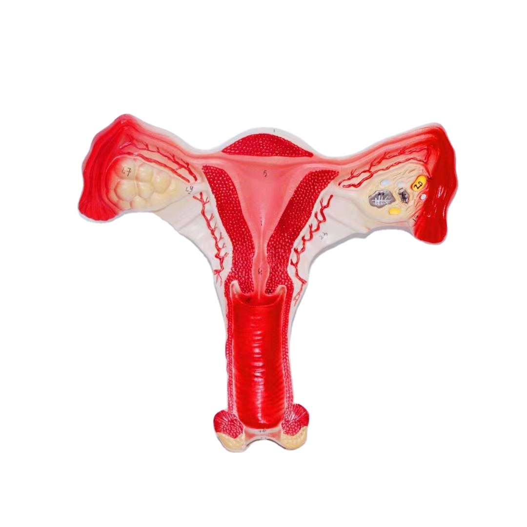 High-quality medical teaching aids demonstration model of human uterus and ovary anatomy