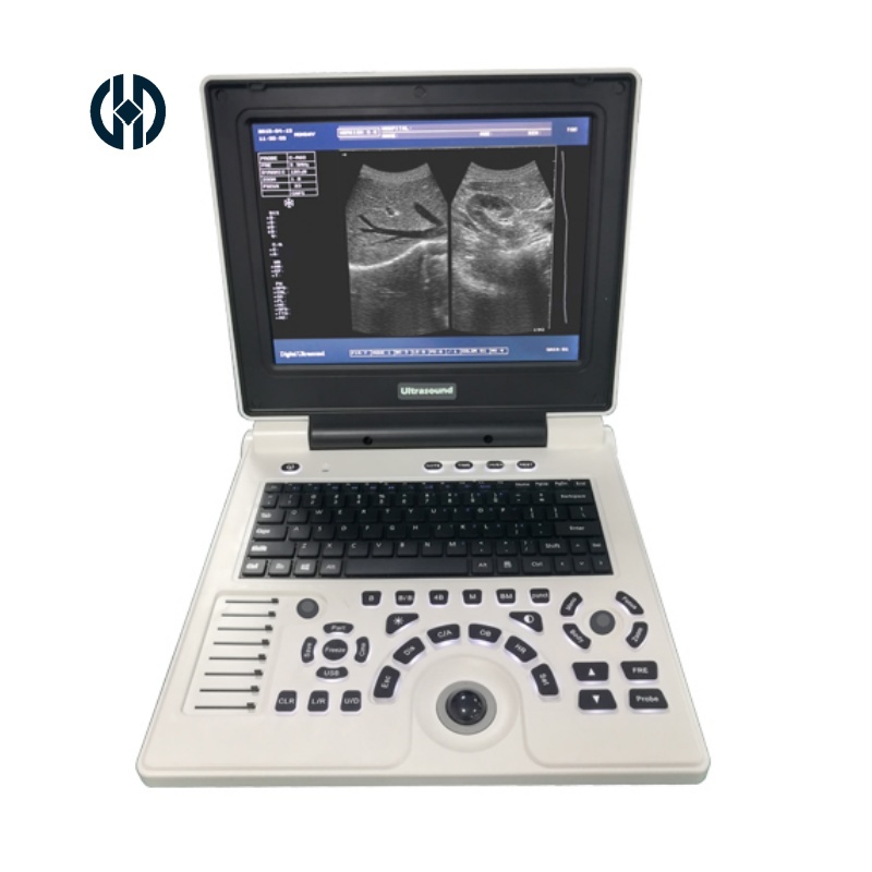Laptop Full Digital Diagnostic System Ultrasound Instruments Ultrasonic Scanner Imaging Portable Ultrasound Machine